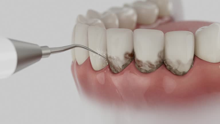 Reliable Dental Implants contractor in Corydon, IA by Smile Center Dentistry